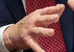 Biely dom vysvetluje naplaste na ruke Trumpa