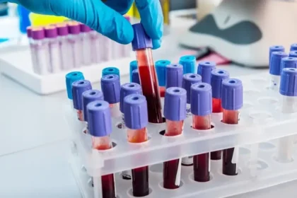 Nový slovenský test môže zrýchliť diagnostiku rakoviny